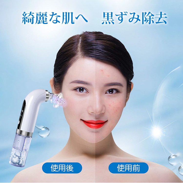 【エステ級 毛穴吸引器】ニキビ吸出し角栓除去 | 吸引しながら毛穴水循環洗浄 | 黒ずみ吸引 フェイスケア | 肌乾燥せず | ブルーライト除菌 毛穴ケア